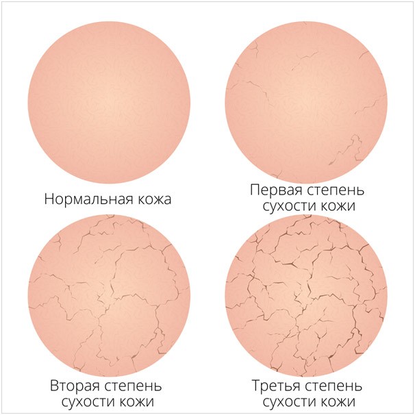 Степень сухости кожи