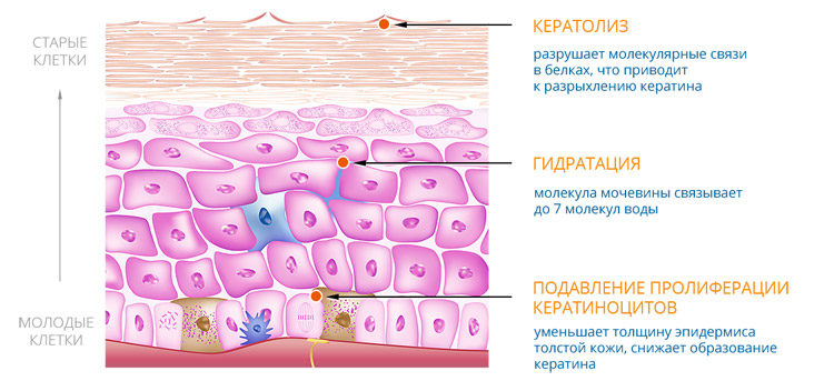 кожа, уход за кожей, мочевина, Уродерм